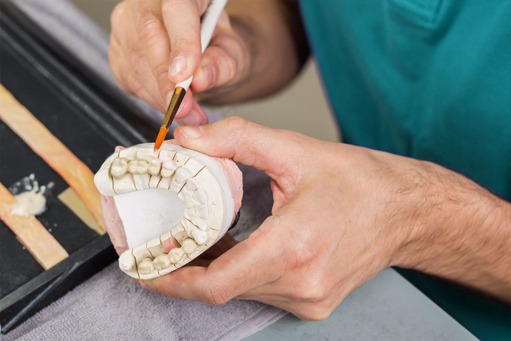 Técnico em Prótese Dentária